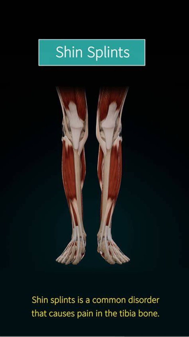Are shin splints chronic?