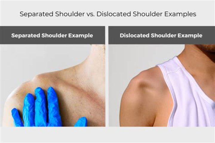 At is a dislocated worker?