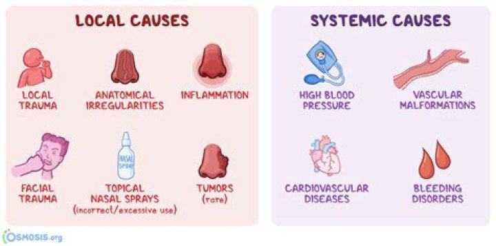 Can epistaxis causes death?