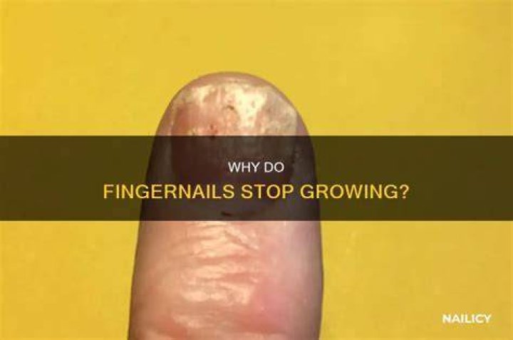 Can fingernails stop growing?