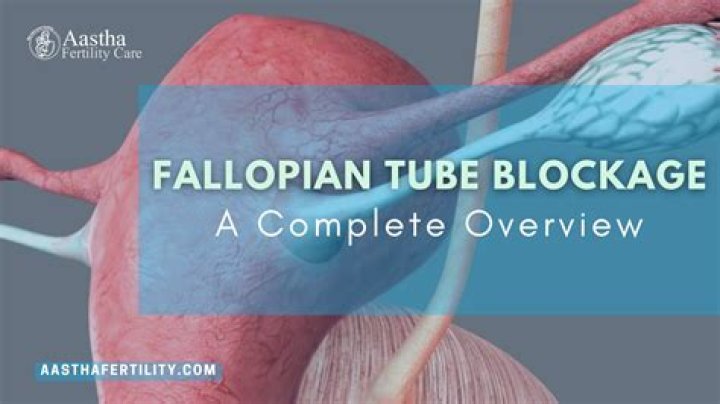 Can laparoscopy open blocked tubes?
