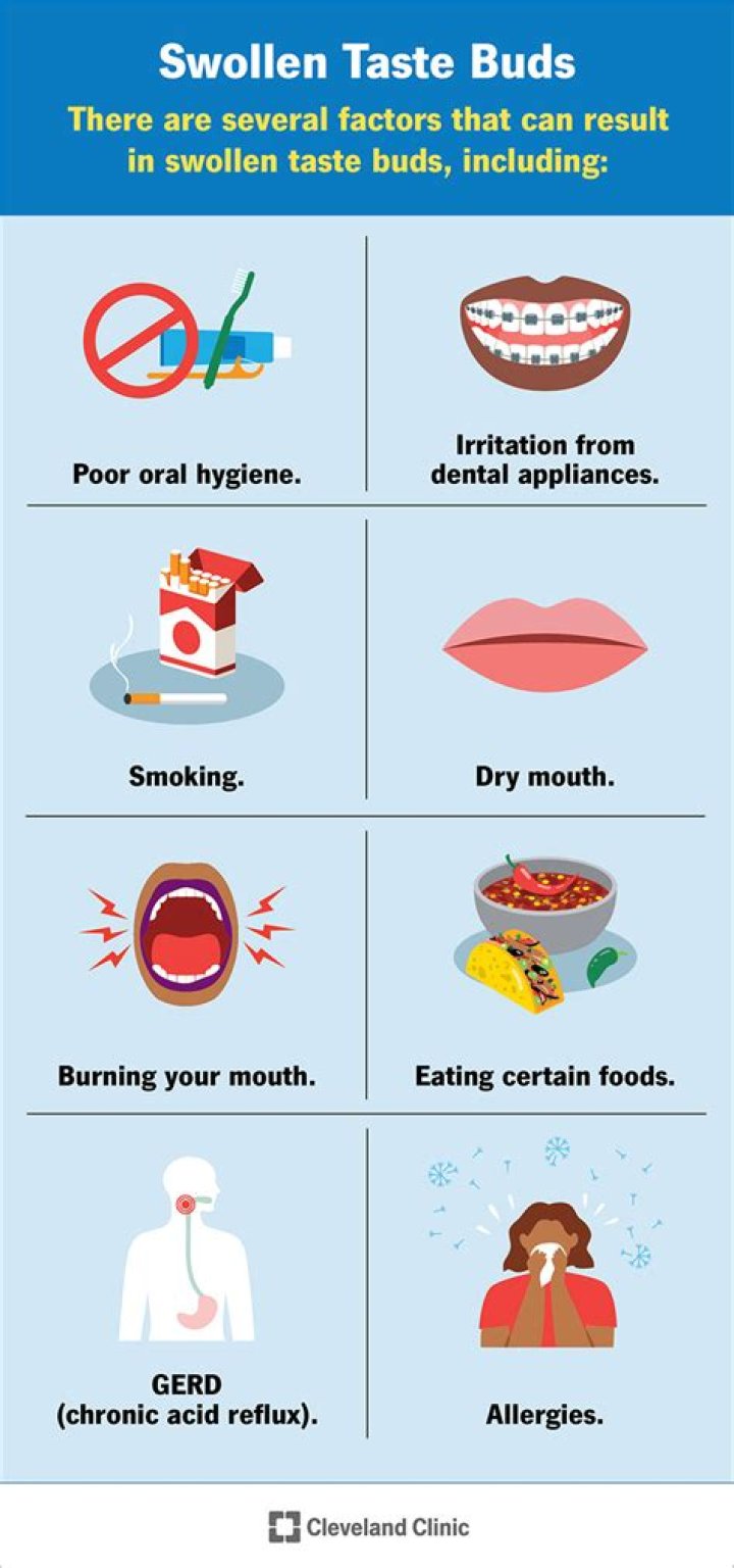 Can u burn your taste bud?