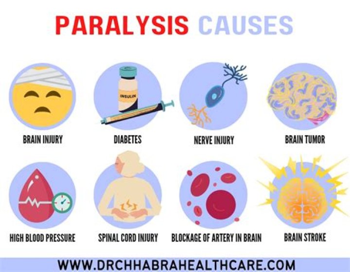 Can you cure paralysis?