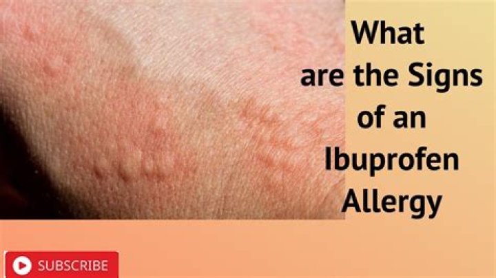 Could ibuprofen cause hives?