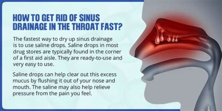 Could sinuses cause bad breath?