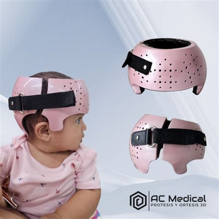 Do cranial helmets really work?