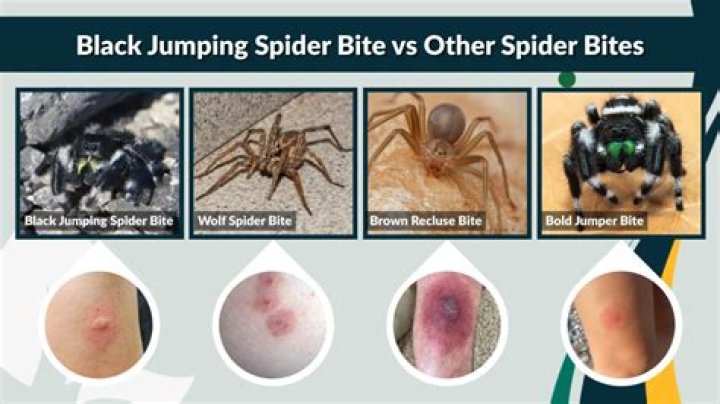 Do jumping spiders bite?
