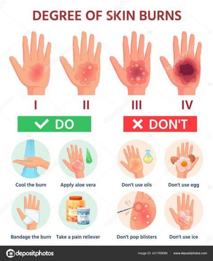 Do third degree burns blister?