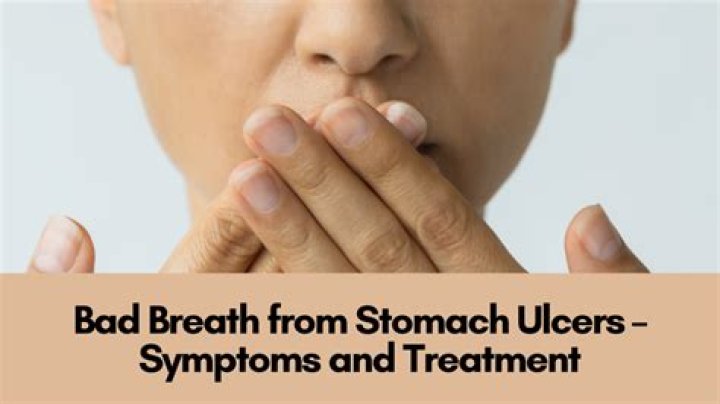 Do ulcers cause bad breath?
