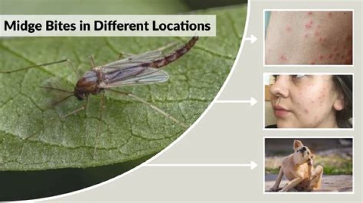 Does a midge bite?
