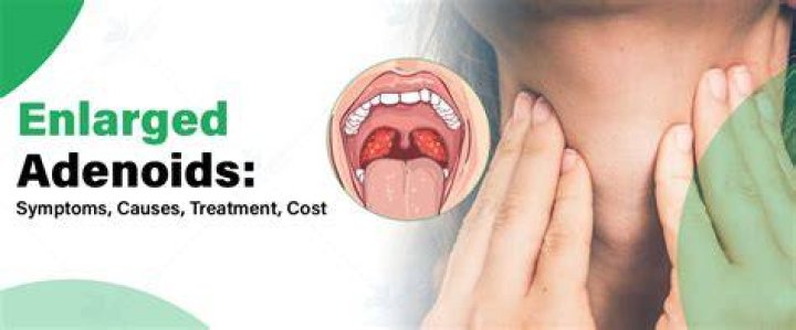 Does adenoids cause fever?
