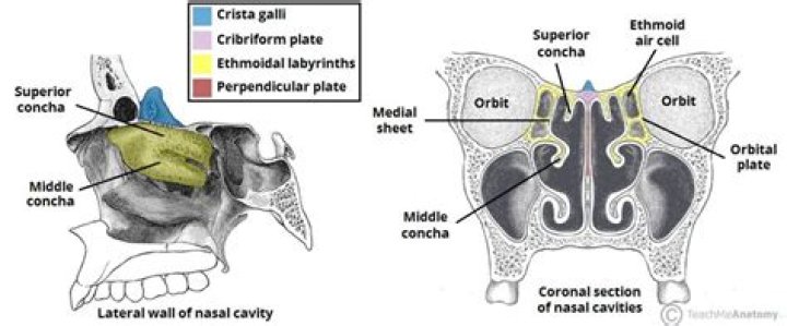Does the ethmoid bone contain sinuses?