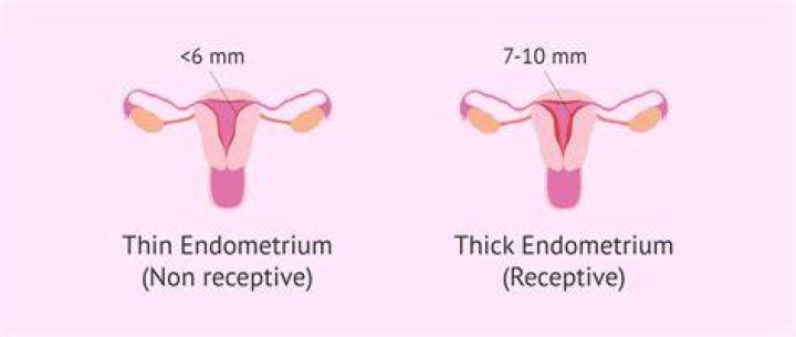 Does thickened endometrium mean pregnancy?