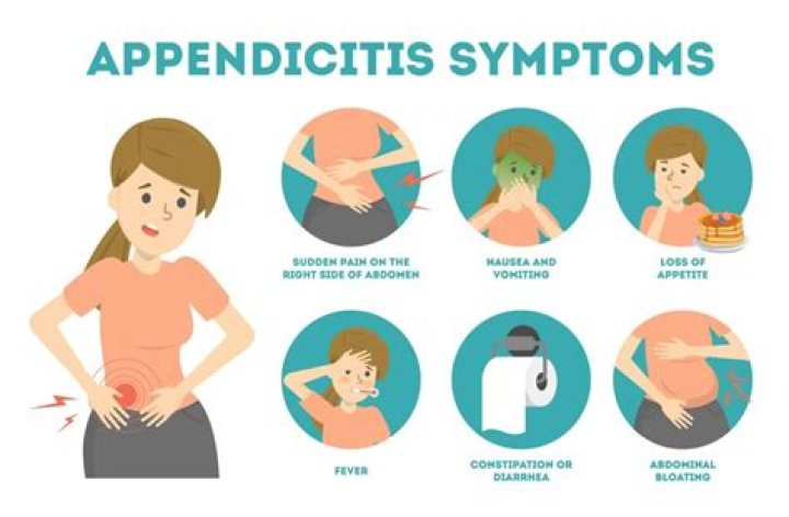 Does your abdomen swell with appendicitis?