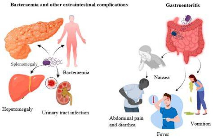 How do you get salmonella enteritidis?