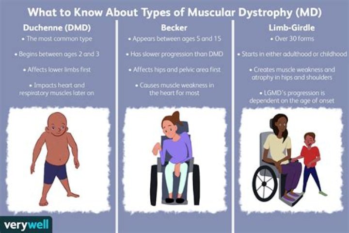 How dystrophy is diagnosed?