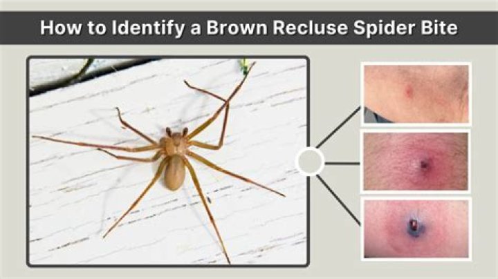 How to identify brown recluse bite?