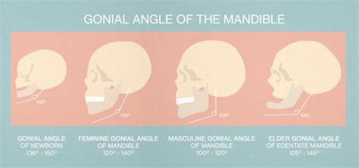 How to increase gonial angle?
