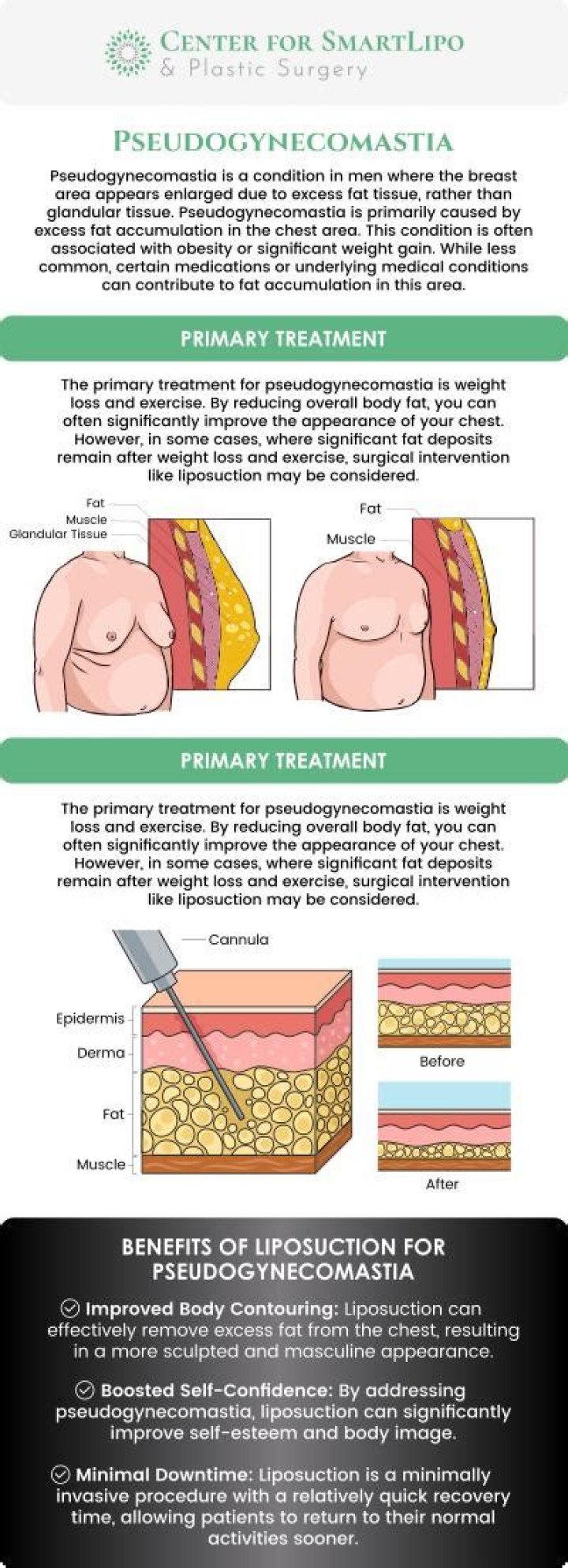 How to reduce pseudogynecomastia?