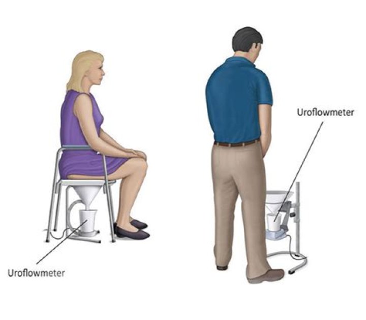 How uroflowmetry test is done?