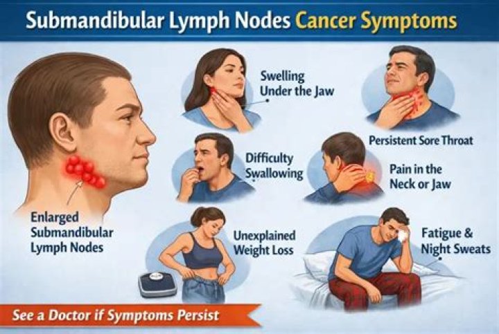 Is lymph node cancer curable?