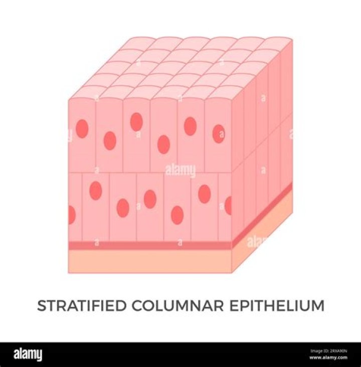 Is stratified epithelium simple?