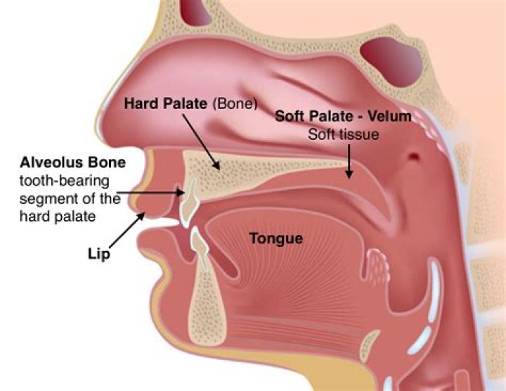 Should soft palate be smooth?