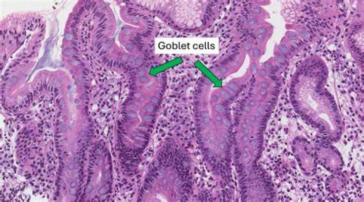 What are goblet cells?