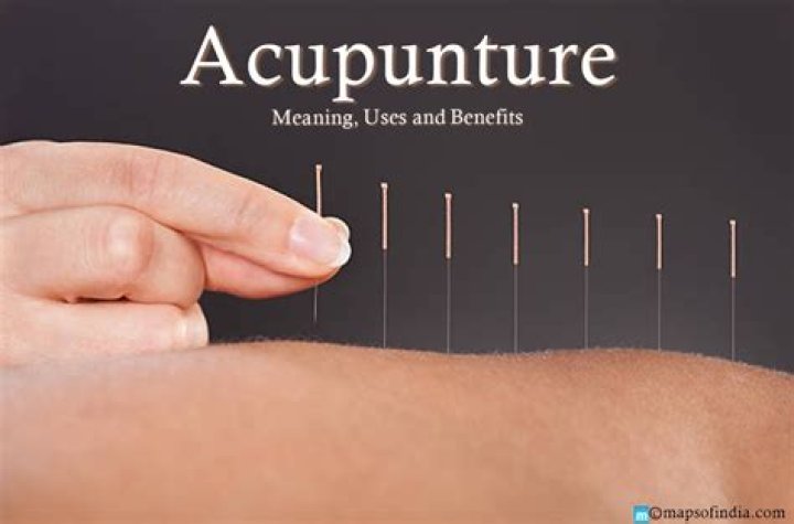 What does acupuncture mean?