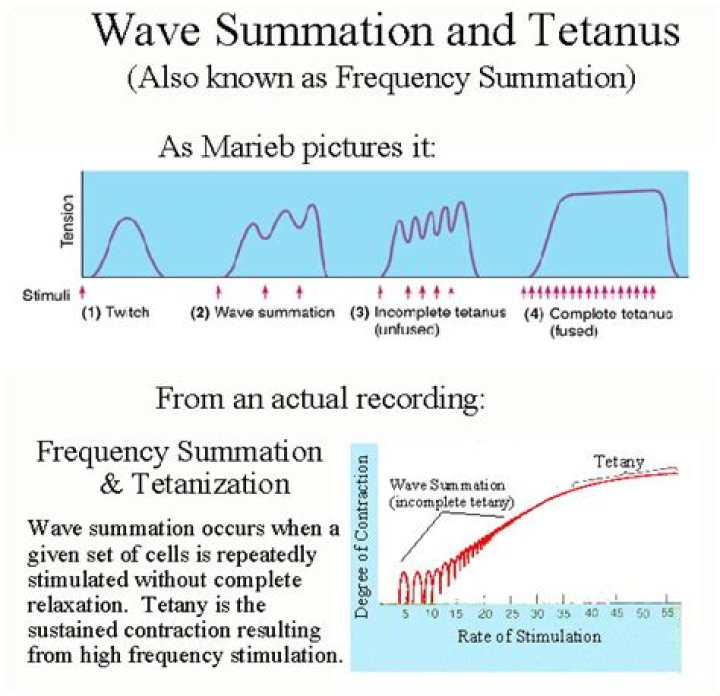 What does the tetanization meaning?