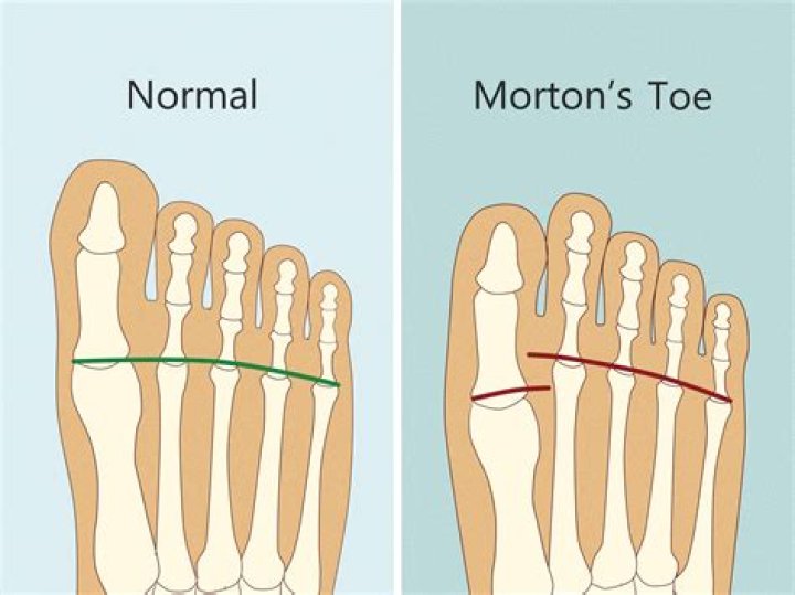 What does toe the mark stand for?