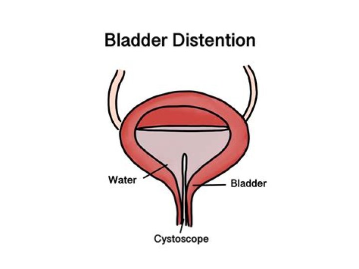 What is a well distended bladder?