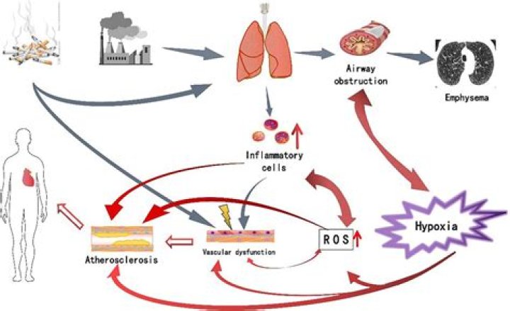 What is an example of pathogenesis?
