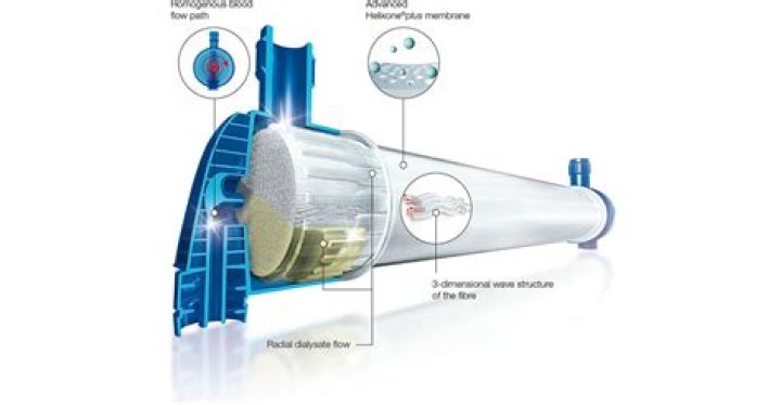 What is dialyzer surface area?