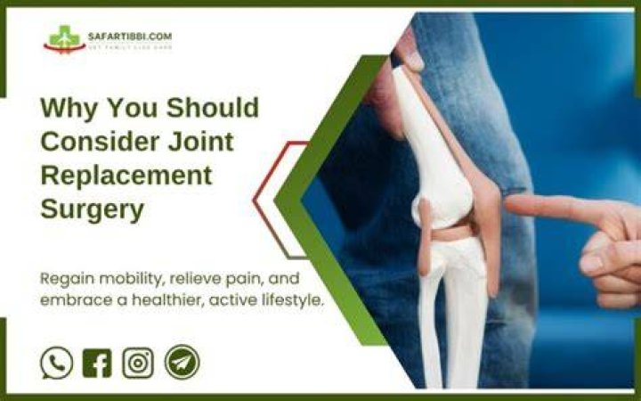 What is joint congruency?