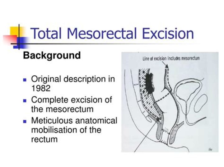What is mesorectal excision?