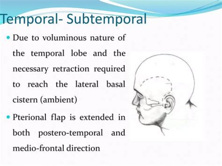 What is subtemporal approach?