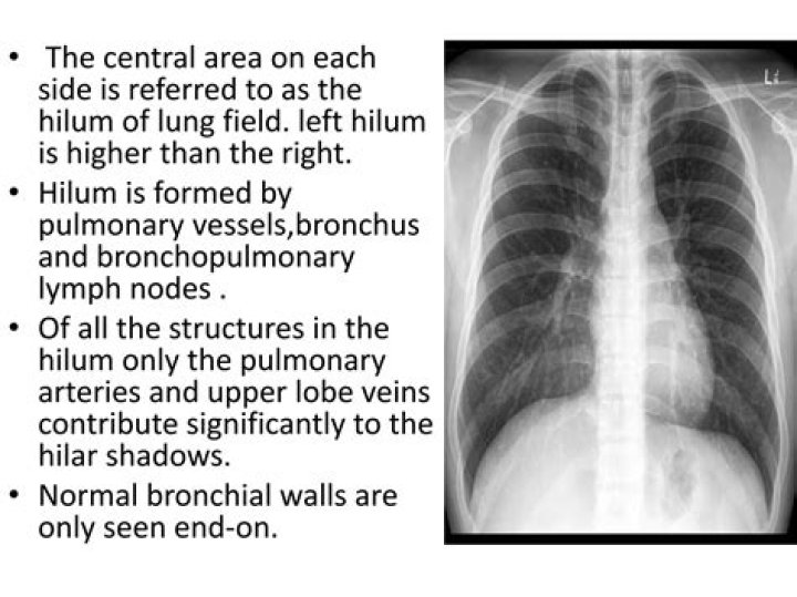 What is the right hilum?