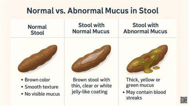 Whats a mushy stool?