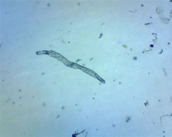 When did flatworms appear?
