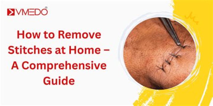 When to remove bandage after stitches?