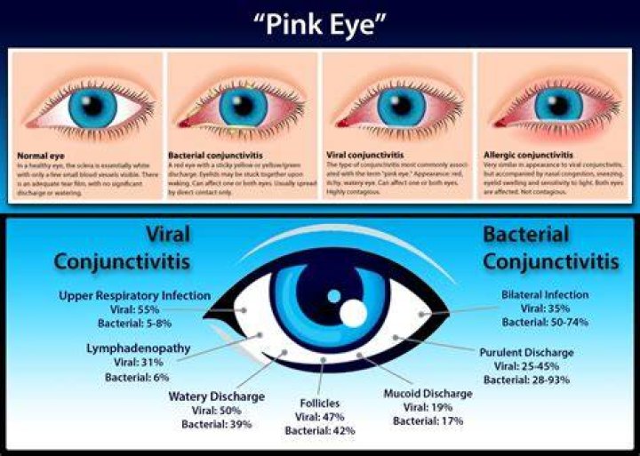 Where do pink eye come from?