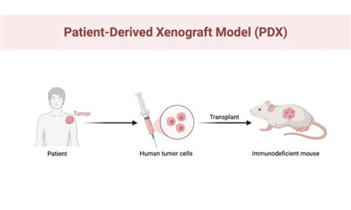 Where is patient derived from?