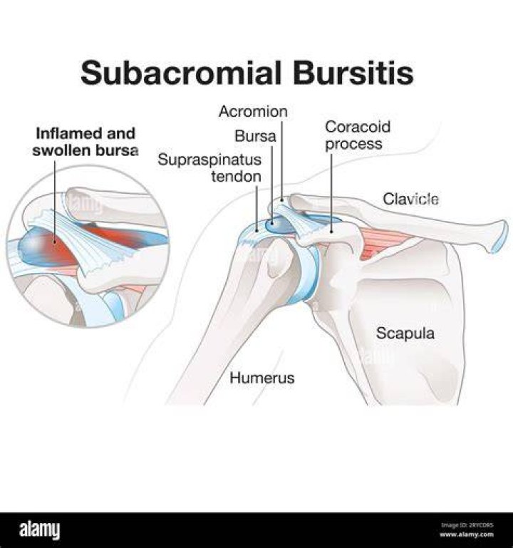Where is supra-acromial bursa?