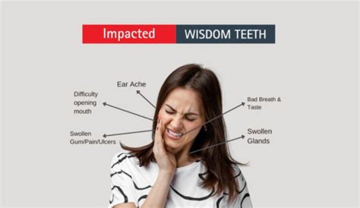 Where is wisdom teeth pain?