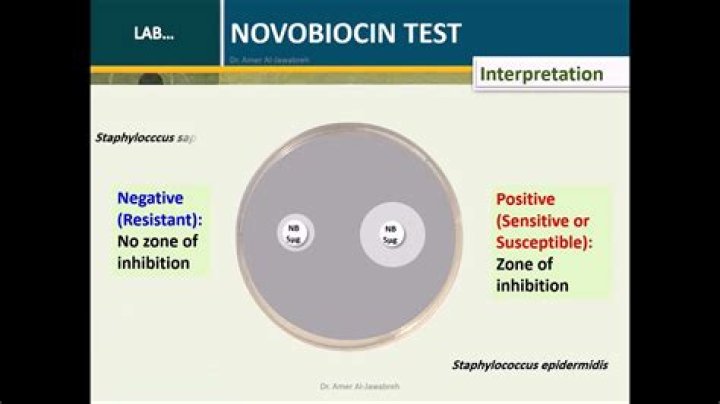 Which microbes) are sensitive to novobiocin?