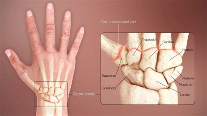 Why does my radiocarpal joint hurt?