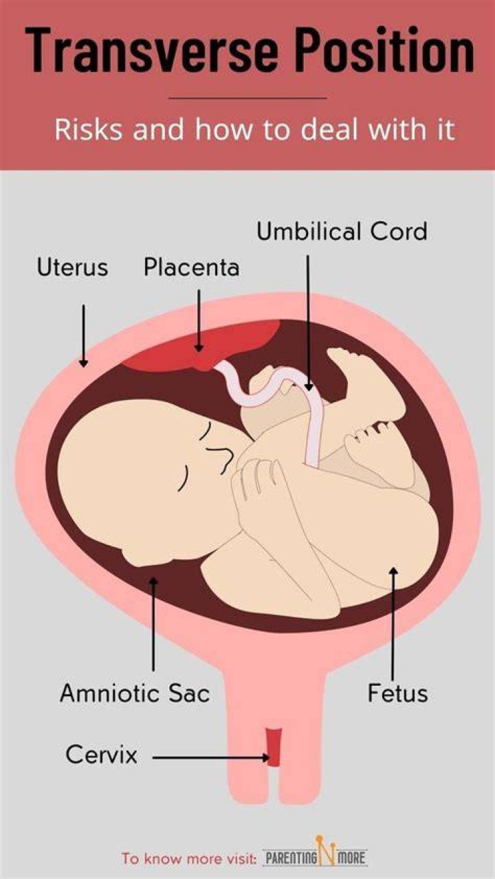 Why is baby transverse?