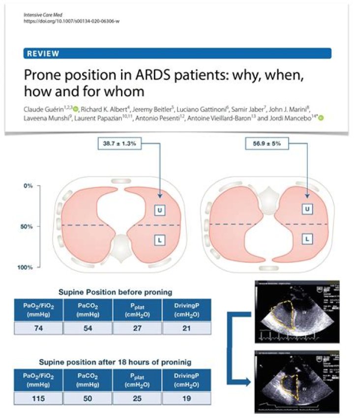 Why prone ards patients?