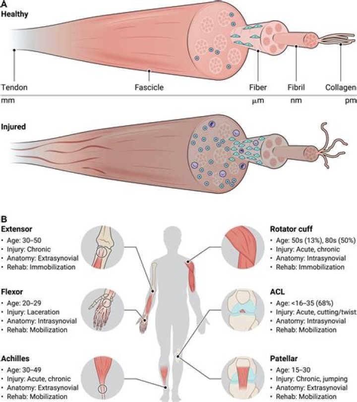 Why tendons are poorly vascularized?